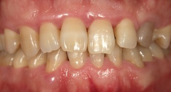 クリーニング　後